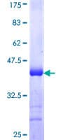 Human MFN1 Protein (Recombinant GST, N-terminus)