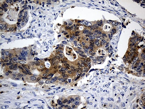 M-PST / STM Antibody (clone OTI5E9)
