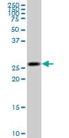 KHK / Ketohexokinase Antibody (clone 1H6-2B6)