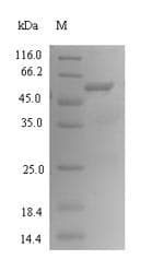 Bacteroides fragilis btfP Protein (Recombinant 6His-SUMO, N-terminus)
