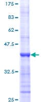 Human MYC / c-Myc Protein (Recombinant GST, N-terminus)