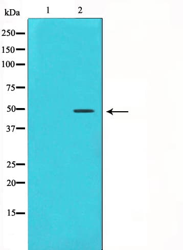 Polyclonal Rabbit anti-Human CCNE1 / Cyclin E1 Antibody (IHC, IF, WB)