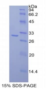 Mouse MAdCAM-1 Protein (Recombinant 6His, N-terminus)