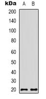 NCBP2 / CBP20 Antibody (N-Terminus)
