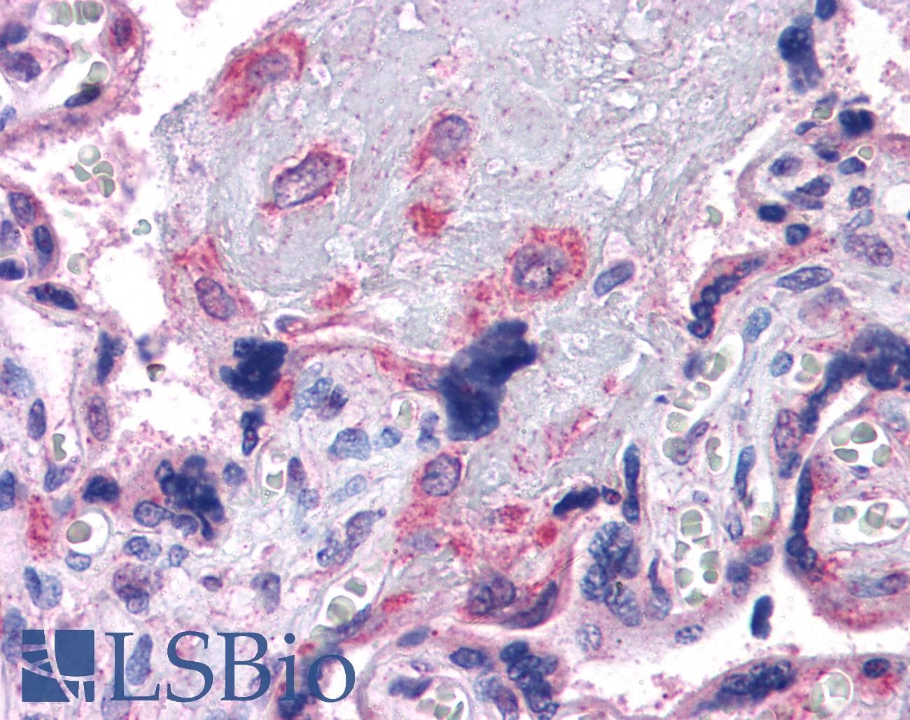 IHC-plus™ Polyclonal Goat anti-Human VPS29 Antibody (aa40-54, IHC)