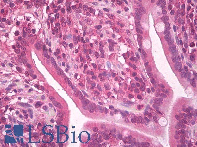IHC-plus™ Polyclonal Goat anti-Human KITLG / SCF Antibody (IHC, WB)