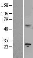 IL15RA Protein (Over-Expression Lysate Myc-DDK (Flag))
