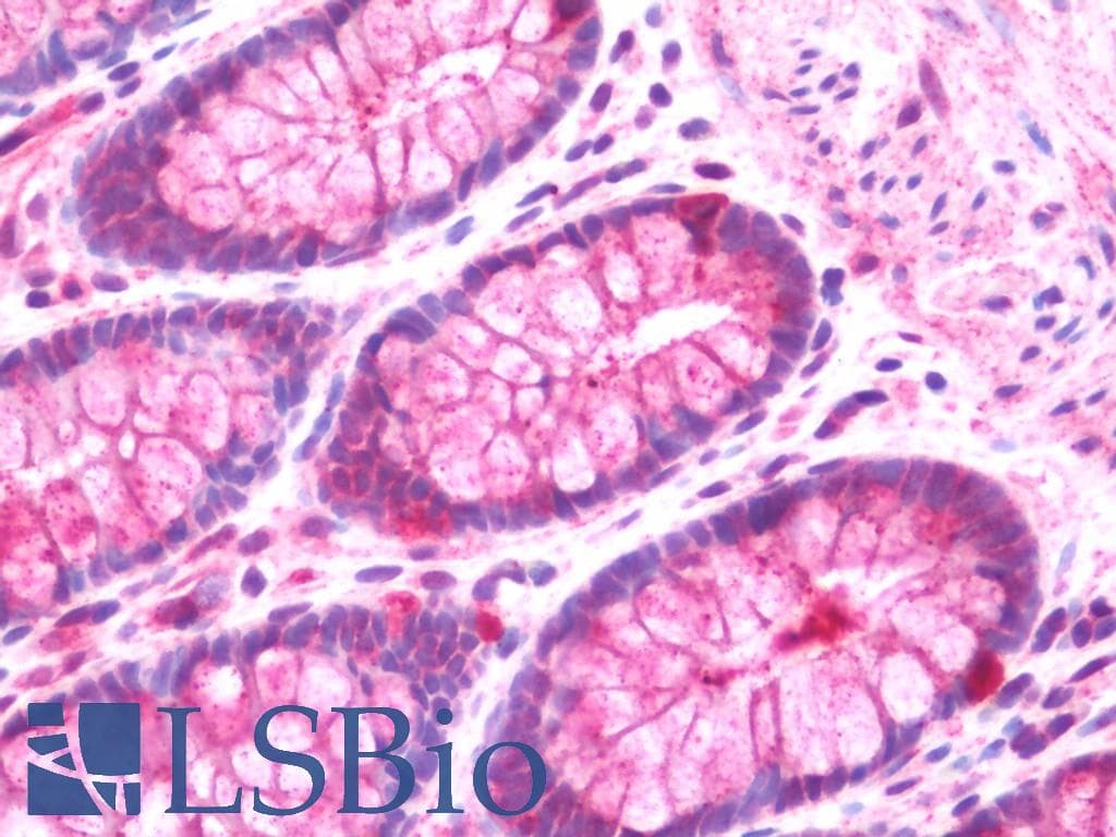 IHC-plus™ BRD3 Antibody (aa672-702)
