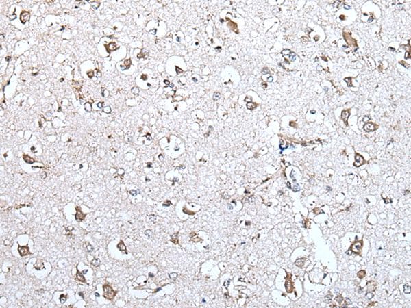 Polyclonal Rabbit anti-Human MCM10 Antibody (IHC)