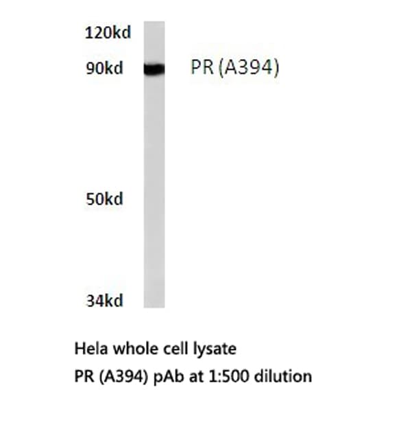 Polyclonal Rabbit anti-Human PR / Progesterone Receptor Antibody (Ala394, IHC, IF, WB)