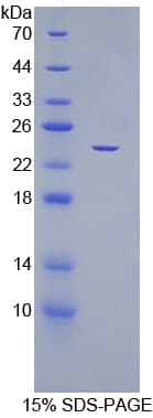 Human CDC25B Protein (Recombinant His)