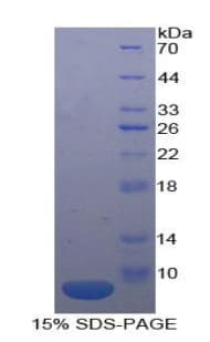 Human CDw218a / IL18R1 Protein (Recombinant His)