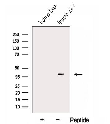 HIBCH Antibody