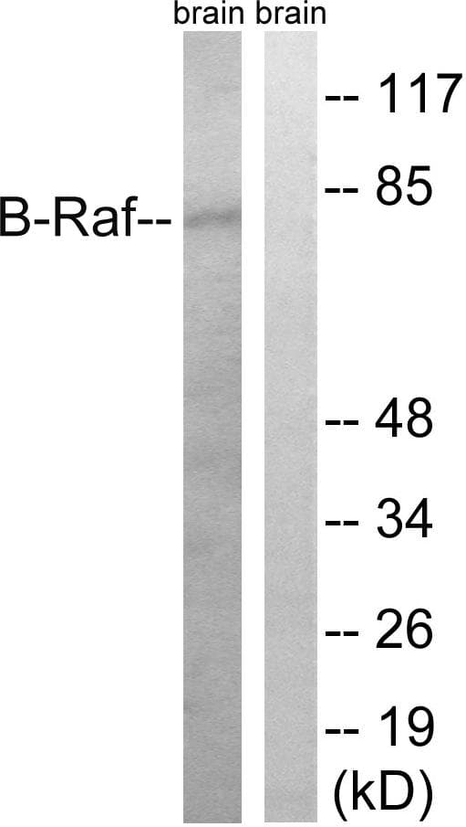BRAF / B-Raf Antibody (p753)