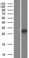 Human SHOX Protein (Over-Expression Lysate Myc-DDK (Flag))