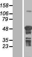 TSPYL4 Protein (Over-Expression Lysate Myc-DDK (Flag))