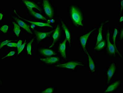 Polyclonal Rabbit anti-Human NEK1 Antibody (IHC, IF)
