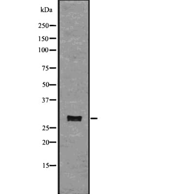 Polyclonal Rabbit anti-Human TNFRSF4 / CD134 / OX40 Antibody (WB)