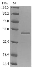 Human IGF1R / IGF1 Receptor Protein (Recombinant 6His, N-terminus)