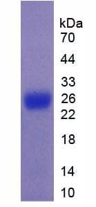 Mouse MUC5B Protein (Recombinant His)