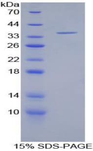 Human ITGAL / CD11a Protein (Recombinant His, N-Terminal)