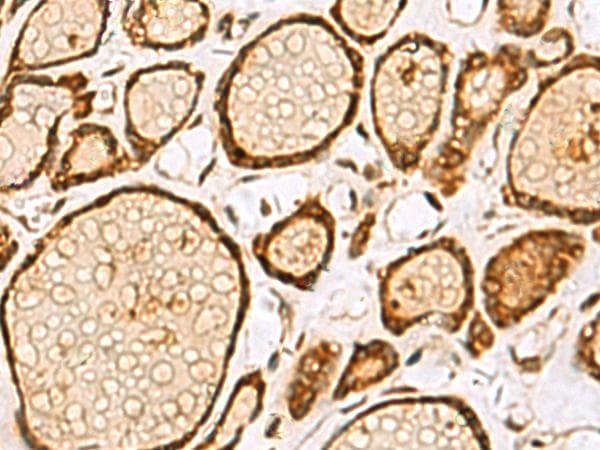 LRRC2 Antibody
