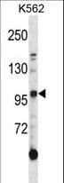 Polyclonal Rabbit anti-Human AXL Antibody (aa122-149, WB)