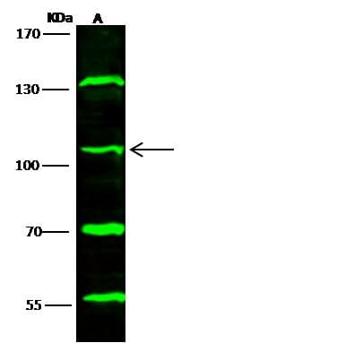TRIM37 / TEF3 Antibody (Preservative Free)