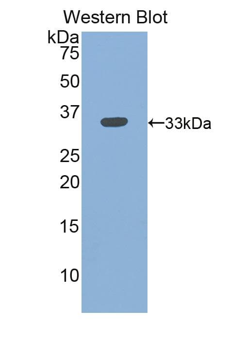 ITGB3 / Integrin Beta 3 / CD61 Antibody (aa135-377, APC)