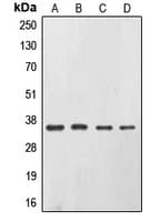 Polyclonal Rabbit anti-Human EPCAM Antibody (Internal, WB)