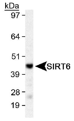 SIRT6 / Sirtuin 6 Antibody (aa300-355)