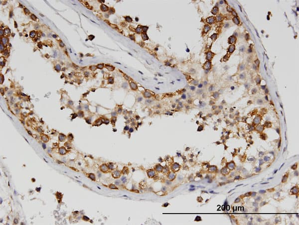Monoclonal Mouse anti-Human ZBP1 Antibody (clone 2C10, IHC, WB)