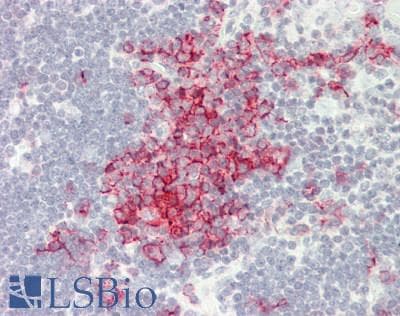 PathPlus™ CD20 Antibody