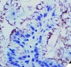 Helicobacter pylori Antibody (Ready-to-Use)