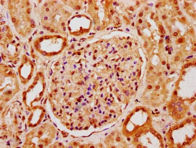 POLE4 / p12 Antibody