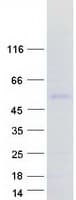 Human SP9 Protein (Recombinant Myc-DDK (Flag))