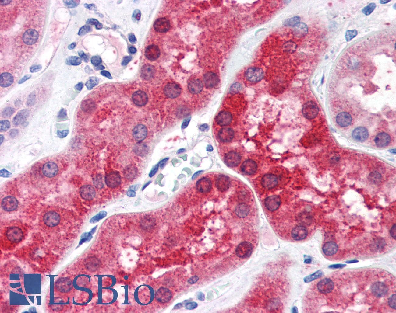 IHC-plus™ ABHD4 Antibody (aa177-187)