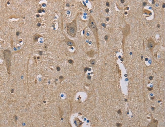 SERPINA1 / Alpha 1 Antitrypsin Antibody