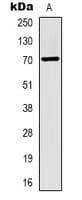 Monoclonal Mouse anti-Human Alpha-Fetoprotein Antibody (IHC, WB)