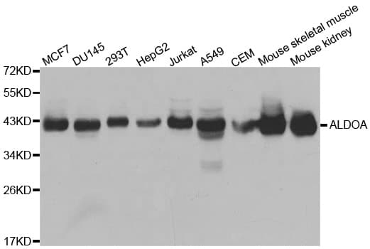 Polyclonal Rabbit anti-Human ALDOA / Aldolase A Antibody (IHC, IF, WB)