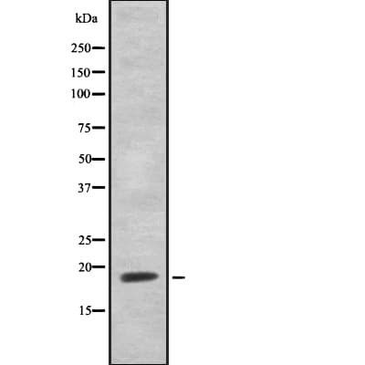 Polyclonal Rabbit anti-Human HEN1 + HEN2 Antibody (IF, WB)
