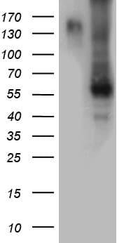 BMP6 Antibody (aa21-374, clone OTI6G9)