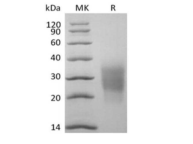 Cynomolgus KLRK1 / CD314 / NKG2D Protein (Recombinant 6His, N-terminus)