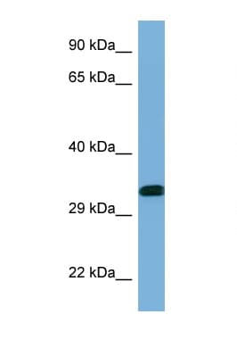 YWHAE / 14-3-3 Epsilon Antibody (C-Terminus)