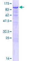 Human LCP2 / SLP-76 Protein (Recombinant GST)