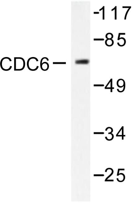 Polyclonal Rabbit anti-Human CDC6 Antibody (Val48, IHC, WB)