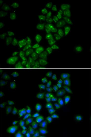 CANT1 Antibody