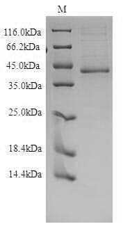 Human EDNRB / Endothelin B Receptor Protein (Recombinant 10His, C-terminus)
