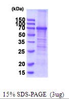 Human CD71 / Transferrin Receptor Protein (Recombinant His)
