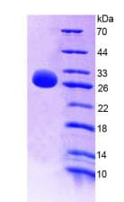 Mouse IL-22BP / IL22RA2 Protein (Recombinant His-T7)